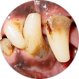 Gel with Wild Salmon Oil. As Seen On TV Pet Dental, Don't Mess with Harsh Chemicals in Your pet's Food or Water, Simply Swipe on Teeth and Your pet's Teeth and Gums Will Improve.-PawvioPets