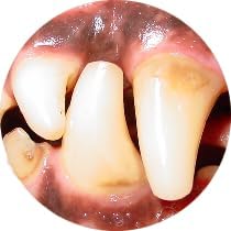 Gel with Wild Salmon Oil. As Seen On TV Pet Dental, Don't Mess with Harsh Chemicals in Your pet's Food or Water, Simply Swipe on Teeth and Your pet's Teeth and Gums Will Improve.-PawvioPets