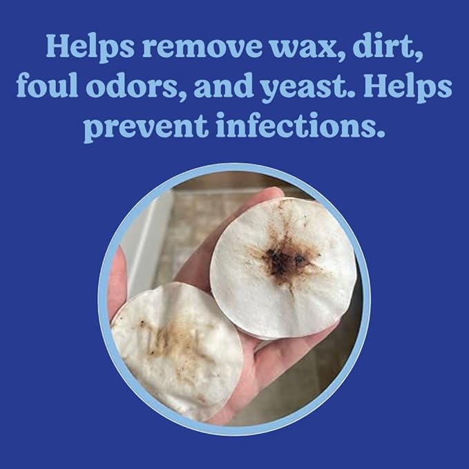 ANGELS' EYES Ear Cleansing Wipes for Dogs & Cats, Removes Dirt, Wax, Odor, Help Reduce Infections & Itching, No Artificial Colors or Fragrance, 100ct-PawvioPets