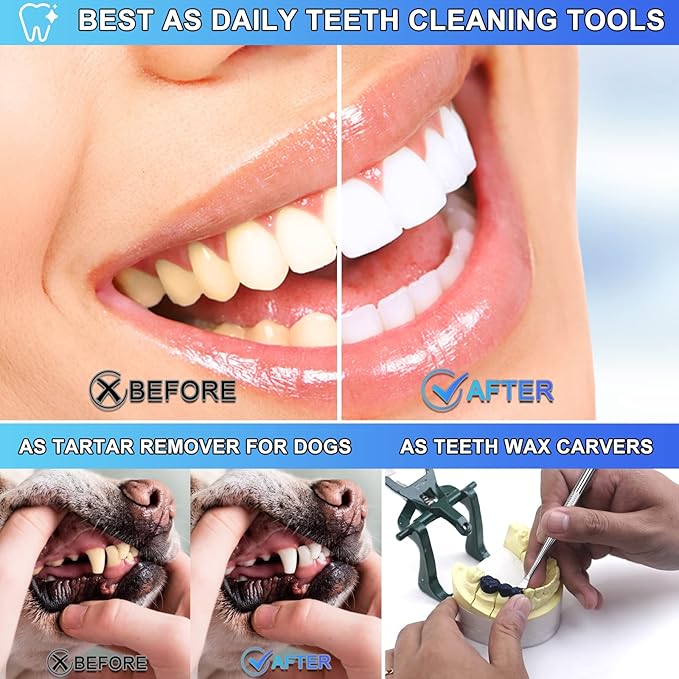 Dental Tools, 3 Pack Teeth Cleaning Tools Stainless Steel Dental Scraper, Pick Hygiene Set for Dentist, Personal Using, Family Oral Care, Pets, Cat, Dog - Tooth Tartar Plaque Scraper Remover-PawvioPets