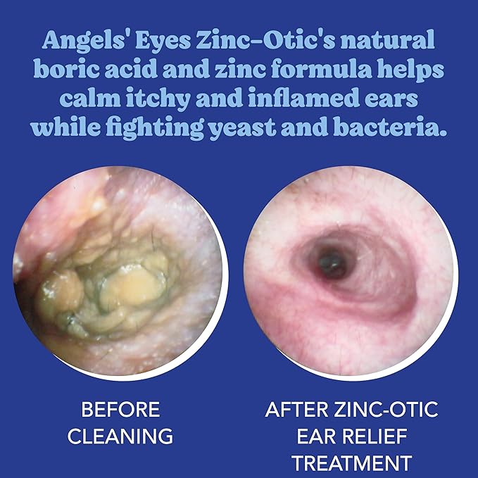 ANGELS’ EYES Zinc-Otic Ear Relief Treatment for Dogs and Cats Soothe Ear Infections Calm Itchy Inflamed Ears Natural BA and Zinc Formula 1 Ounce-PawvioPets